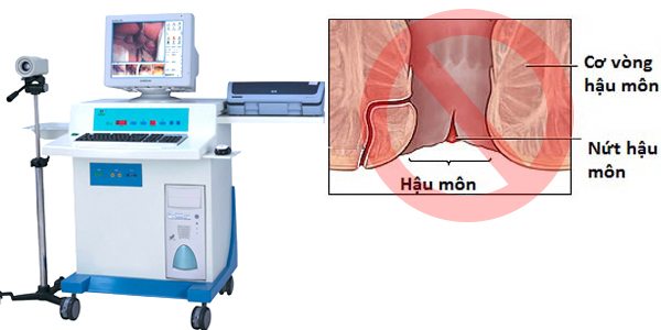 Chữa nứt kẽ hậu môn ở đâu hiệu quả