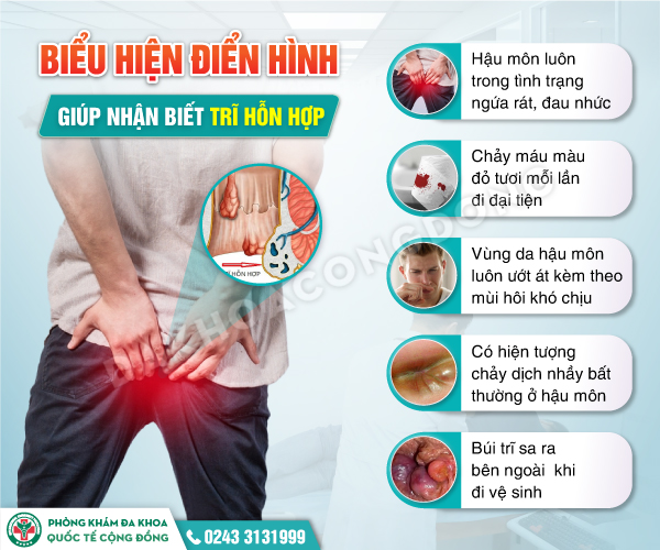 Cập Nhật Bảng Giá Chữa Trĩ Hỗn Hợp 2025
