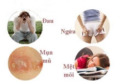 Triệu chứng rò hậu môn