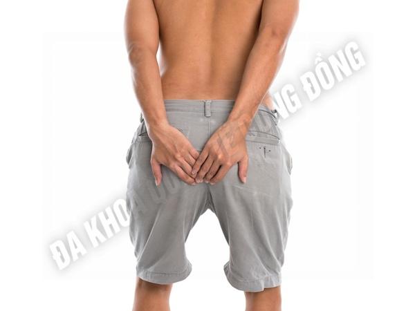 bệnh trĩ ngoại và phương pháp điều trị 