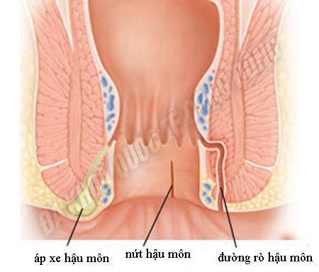 ro hau mon 0
